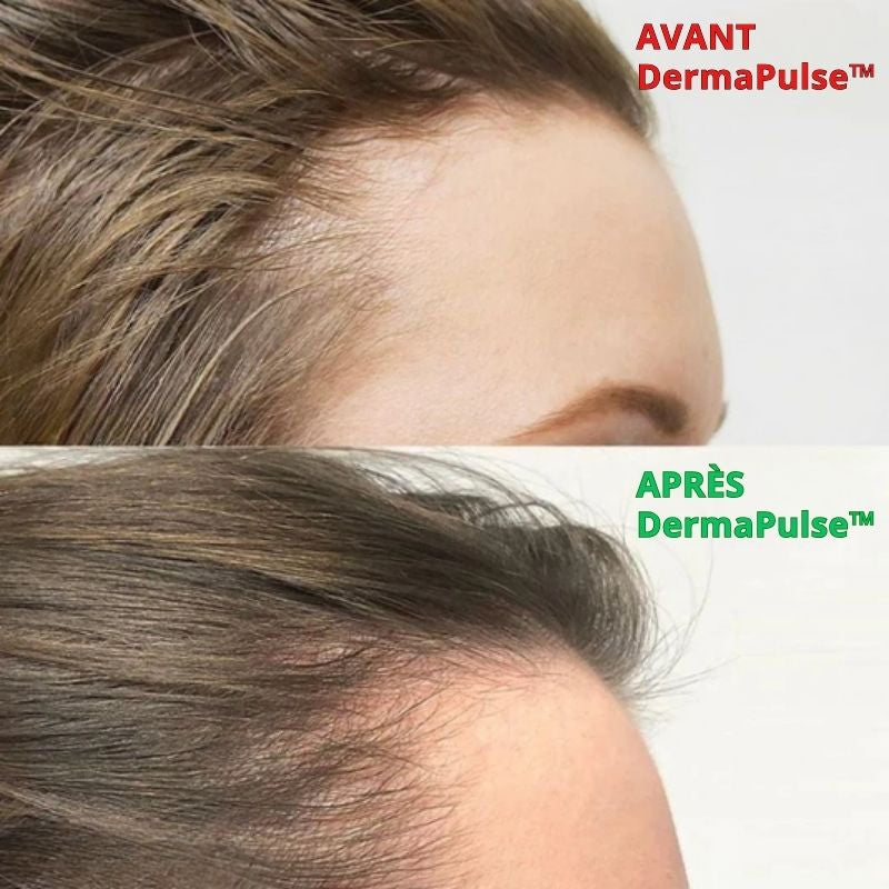 DermaPulse™