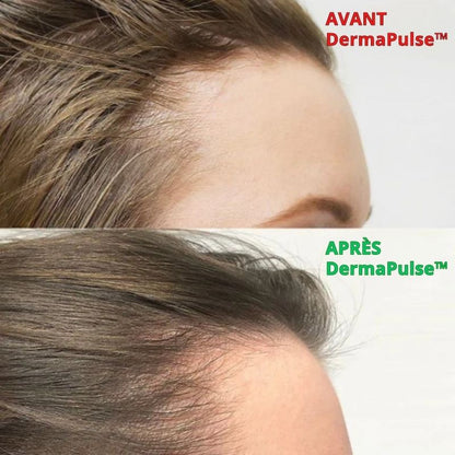 DermaPulse™